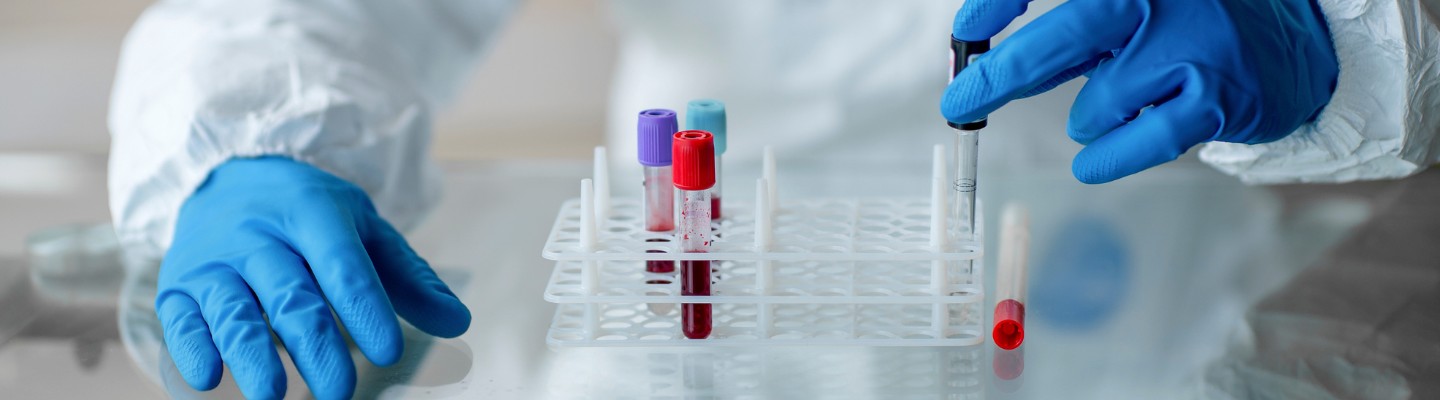 Test tubes with blood